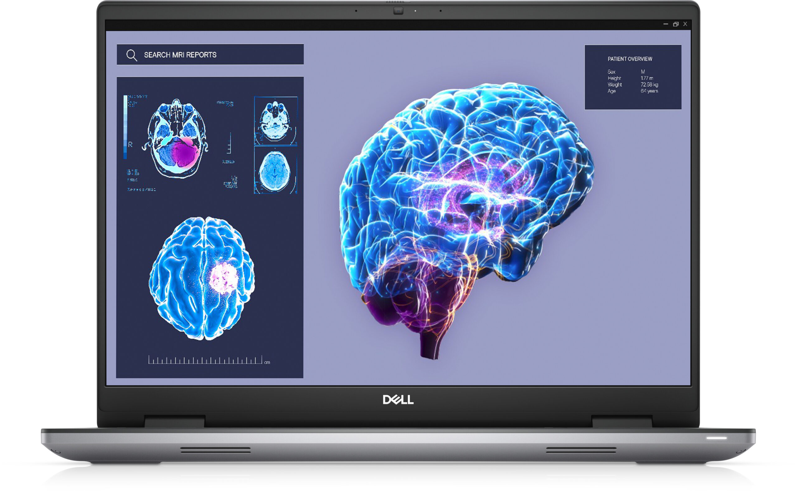 DELL Precision 7680 Intel® Core™ i9 i9-13950HX Mobiel werkstation 40,6 cm (16") Full HD+ 32 GB DDR5-SDRAM 1 TB SSD NVIDIA RTX 3500 Ada Wi-Fi 6E (802.11ax) Windows 11 Pro Grijs